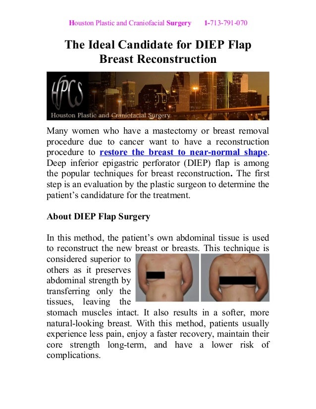houston breast reconstruction Bangor maine sex videos